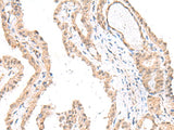 Anti-Human FANCE Antibody - ABMIUM