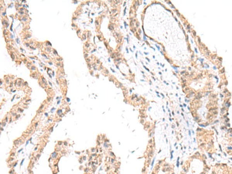Anti-Human FANCE Antibody - ABMIUM
