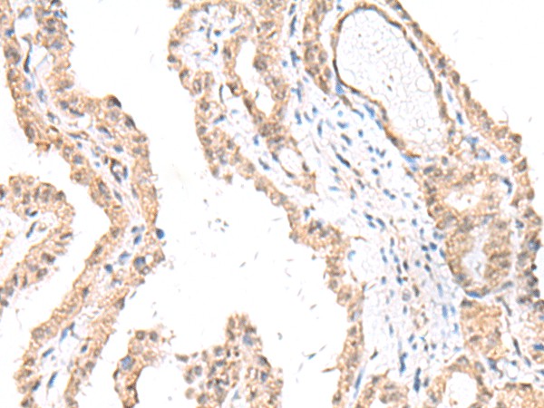 Anti-Human FANCE Antibody - ABMIUM
