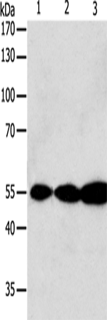Anti-Human/Mouse/Rat GSR Antibody - ABMIUM