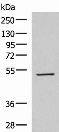 Anti-Human/Mouse/Rat FDXR Antibody