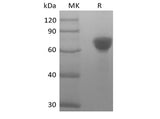 Recombinant Human Tumor-associated Calcium Signal Transducer 2/TROP-2 (248AA, C-Fc) - ABMIUM