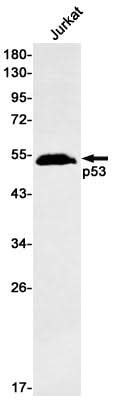 Western blot detection of p53 in Jurkat cell lysates using p53 Rabbit mAb(1:500 diluted).Predicted band size:44kDa.Observed band size:53kDa.