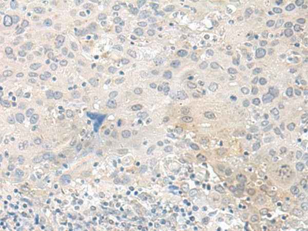 Anti-Human/Mouse TUBG2 Antibody
