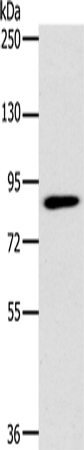Anti-Human/Mouse PLEKHG6 Antibody - ABMIUM