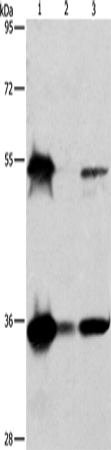 Anti-Human BAG1 Antibody - ABMIUM