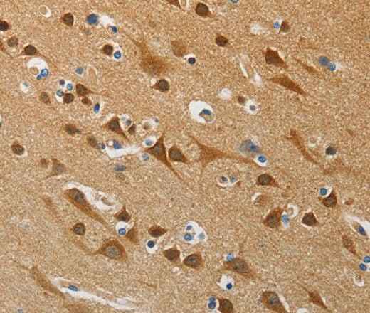 Anti-Human ATG4B Antibody