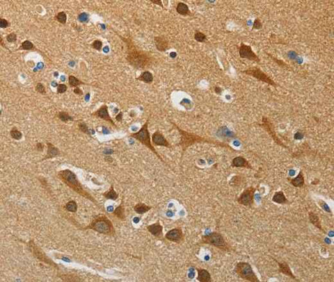 Anti-Human ATG4B Antibody