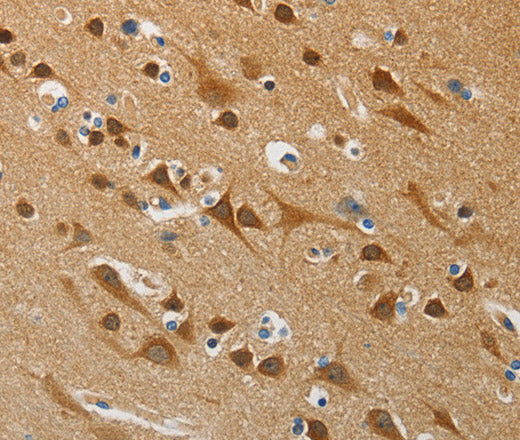 Anti-Human ATG4B Antibody - ABMIUM