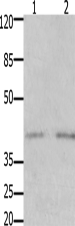 Anti-Human/Mouse/Rat GFRA3 Antibody - ABMIUM