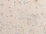Immunohistochemistry of paraffin-embedded Human brain tissue using PPM1D Polyclonal Antibody at dilution of 1:60(×200)