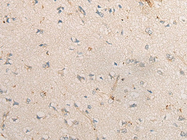 Immunohistochemistry of paraffin-embedded Human brain tissue using PPM1D Polyclonal Antibody at dilution of 1:60(×200)