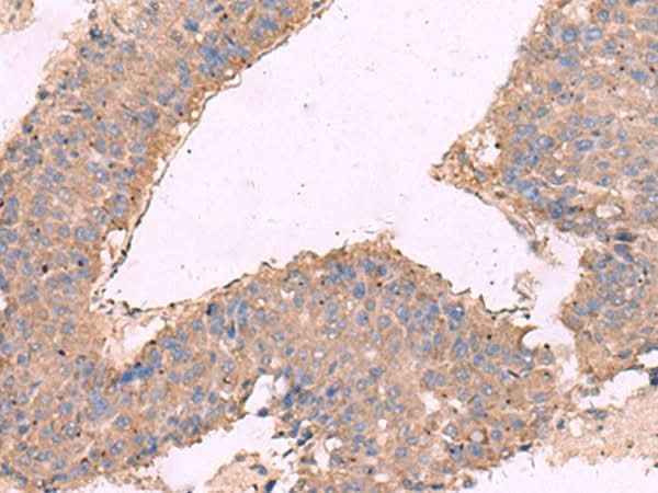 Anti-Human/Mouse/Rat KCNN3 Antibody