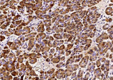 Anti-Human REG1B Antibody [B331]