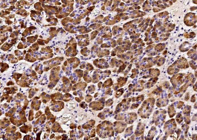 Anti-Human REG1B Antibody [B331] - ABMIUM