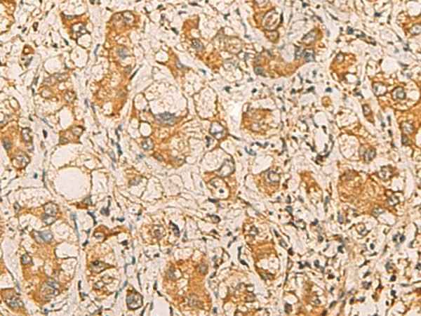 Anti-Human/Mouse/Rat MRPL9 Antibody