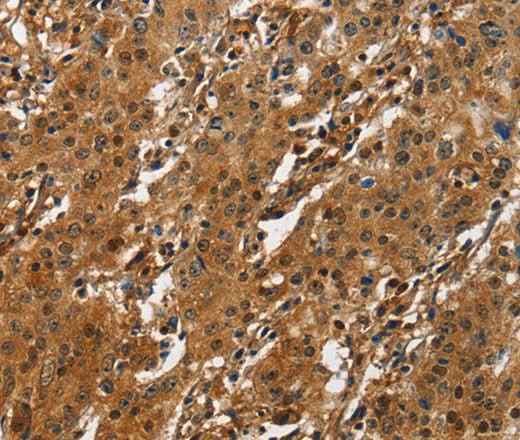 Anti-Human/Mouse/Rat ATF4 Antibody