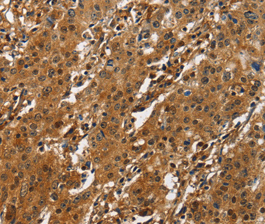 Anti-Human/Mouse/Rat ATF4 Antibody - ABMIUM