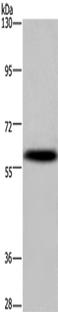 Anti-Human/Mouse KCNG4 Antibody - ABMIUM