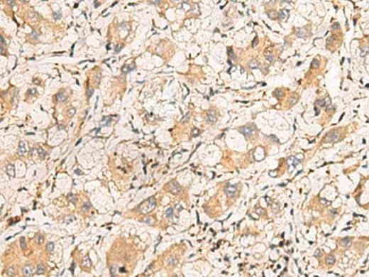 Anti-Human TNNT1 Antibody