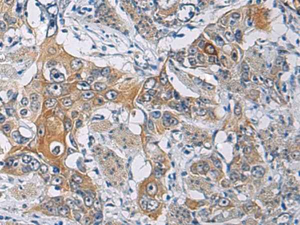 Anti-Human/Mouse/Rat KCNJ10 Antibody