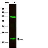 Anti-Human LCN2 Antibody [B229]