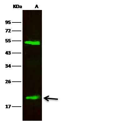 Anti-Human LCN2 Antibody [B229] - ABMIUM