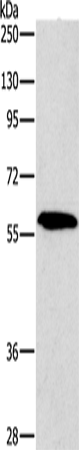 Anti-Human/Mouse/Rat PAK2 Antibody - ABMIUM