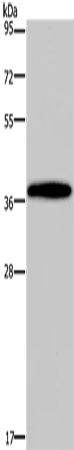 Anti-Human/Mouse DLX4 Antibody - ABMIUM