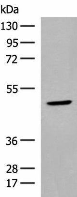 Western blot analysis of Human thyroid tissue lysate using ZBTB8A Polyclonal Antibody at dilution of 1:350