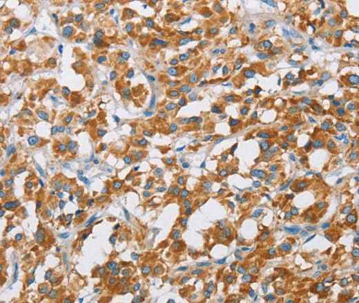 Anti-Human/Mouse/Rat BDH1 Antibody