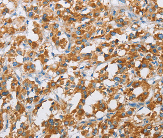 Anti-Human/Mouse/Rat BDH1 Antibody - ABMIUM