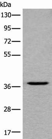 Anti-Human LDAH Antibody