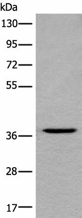 Anti-Human LDAH Antibody - ABMIUM