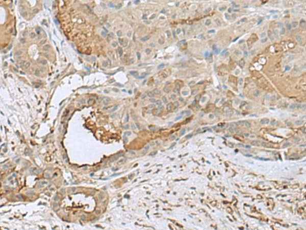 Anti-Human/Mouse/Rat GABARAPL2 Antibody