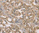 Anti-Human/Mouse DACH2 Antibody - ABMIUM