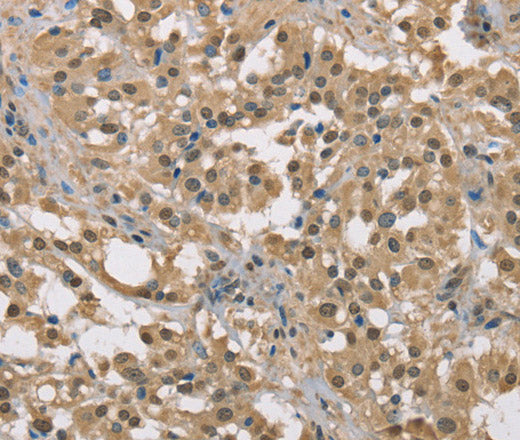 Anti-Human/Mouse DACH2 Antibody - ABMIUM