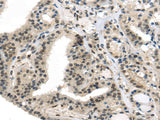 Anti-Human/Mouse/Rat TUSC5 Antibody - ABMIUM