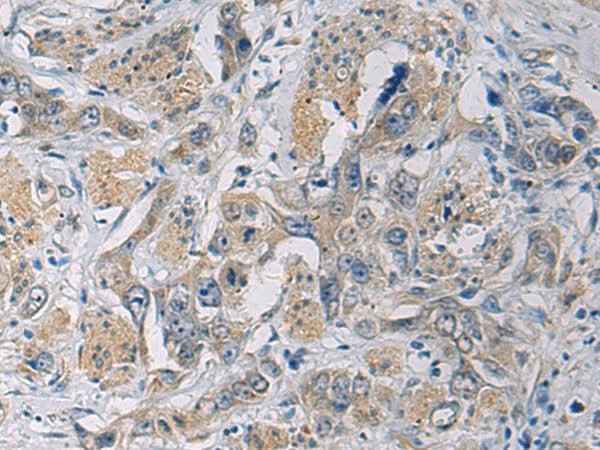 Anti-Human/Mouse/Rat CYTIP Antibody