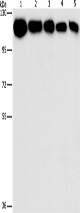 Anti-Human/Mouse/Rat HK2 Antibody - ABMIUM