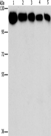 Anti-Human/Mouse/Rat HK2 Antibody - ABMIUM