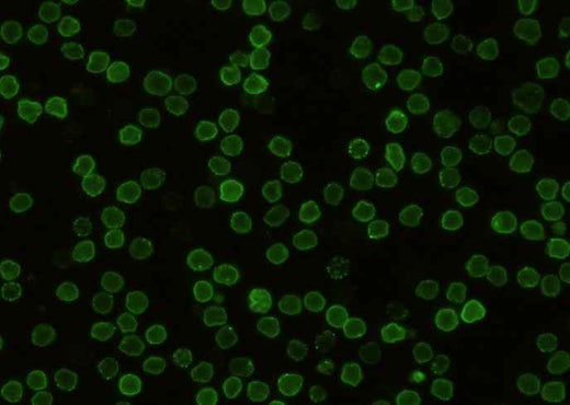 Anti-Mouse CD48 Antibody [B446] - ABMIUM