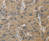 Anti-Human TBXAS1 Antibody - ABMIUM