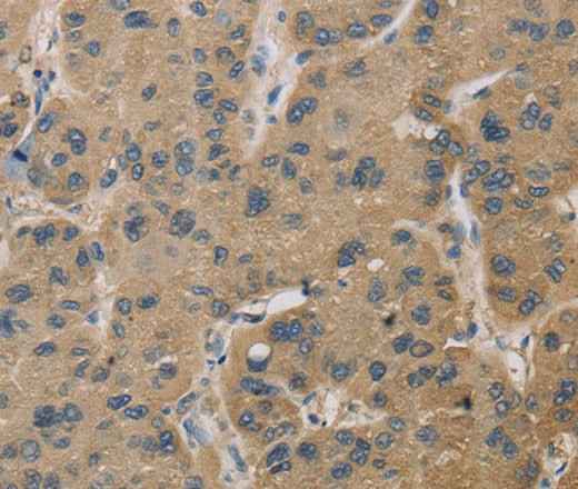 Anti-Human TBXAS1 Antibody