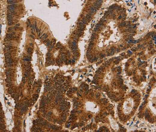 Anti-Human/Mouse/Rat CSNK2B Antibody