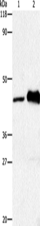 Anti-Human/Mouse/Rat HTR1A Antibody - ABMIUM