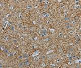 Anti-Human/Mouse/Rat PGLYRP1 Antibody - ABMIUM