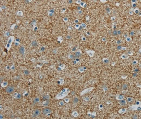 Anti-Human/Mouse/Rat PGLYRP1 Antibody - ABMIUM