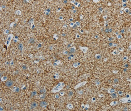 Anti-Human/Mouse/Rat PGLYRP1 Antibody - ABMIUM