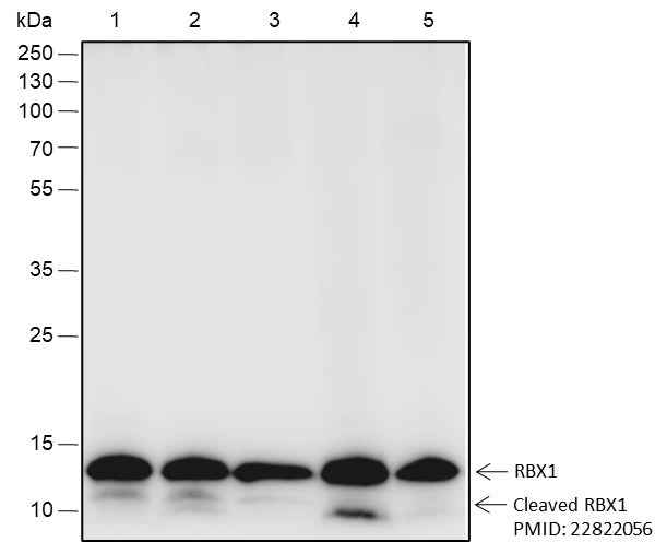Anti-Human/Rat/Mouse RBX1 Antibody [A501]